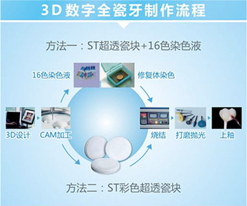 口腔專區項目詳情 數字內容制作服務全面解析